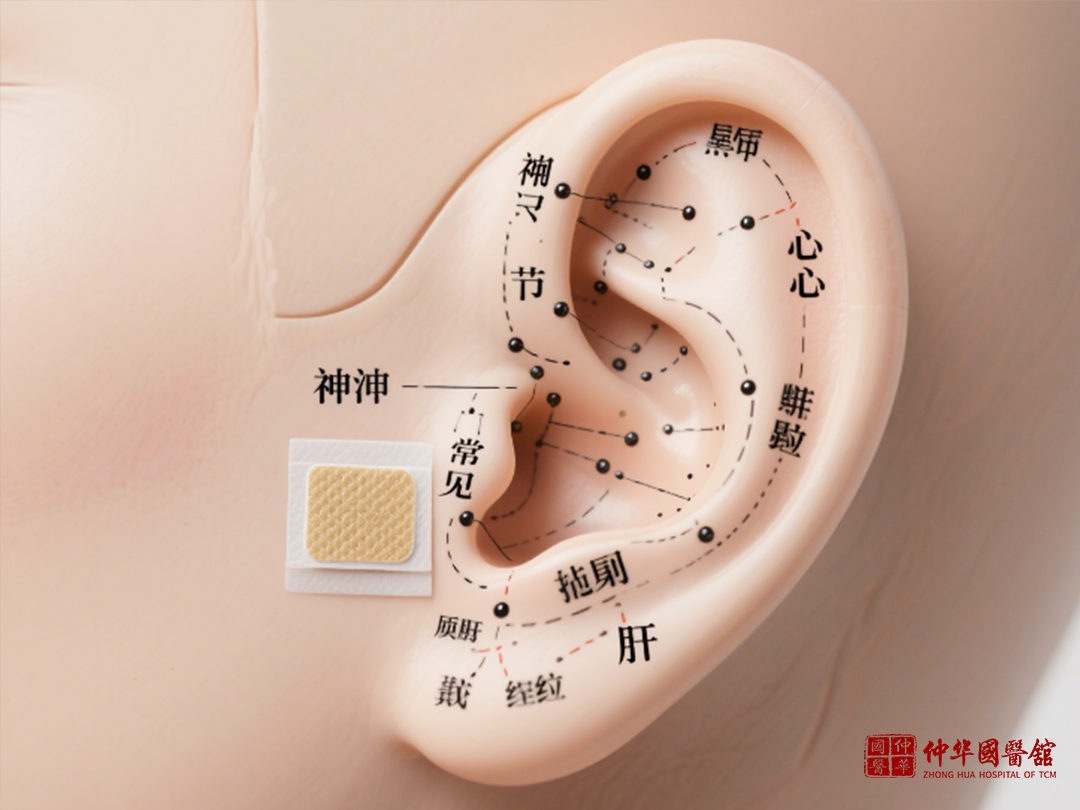 年轻人的新时尚——耳穴