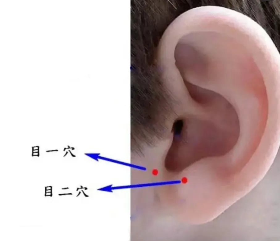 孩子视力差别只盯屏幕！肝脾肾失调才是根源，5 个中医护眼方收好