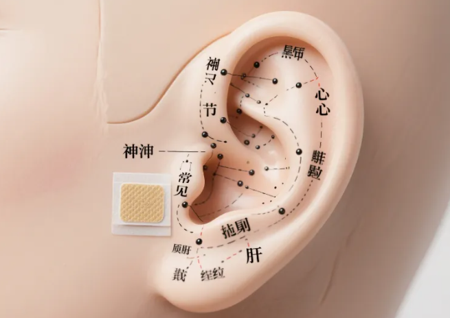 义诊福利|小巧耳穴贴,轻松伴日常